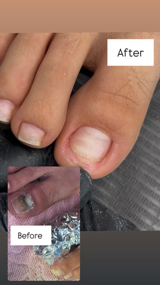 Healthy Nail Growth