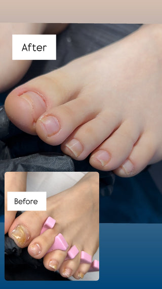 Healthy Nail Growth