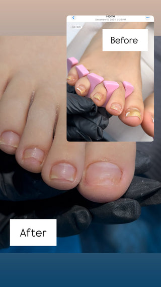 Healthy Nail Growth